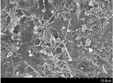 Βακτηριακή Βιομεμβράνη: Biofilm
